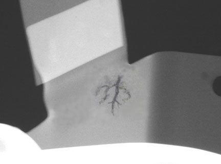 Radiograph of Dendritic shrinkage.