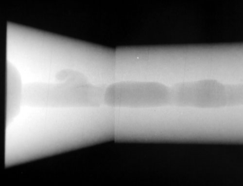 Radiograph of Cavity shrinkage.