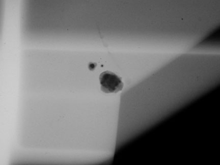 Radiograph of Sand inclusions and dross.