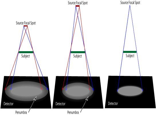 When there is a large source size, the rays come from multiple points are create a blurred image (larger penumbra). The distance between the subject and source can also effect teh size of the penumbra.