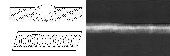Cross-sectional view, top view, and Radiograph of External Undercut.