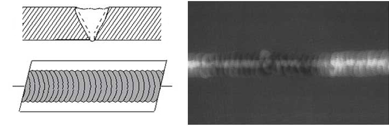 Cross-sectional view, top view, and Radiograph of Inadequate Reinforcement.