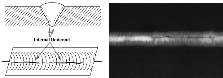Cross-sectional view, top view, and Radiograph of Internal Undercut.