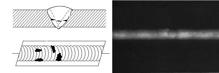 Cross-sectional view, top view, and Radiograph of Cold lap.