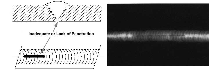 Cross-sectional view, top view, and Radiograph of Lack of Penetration.