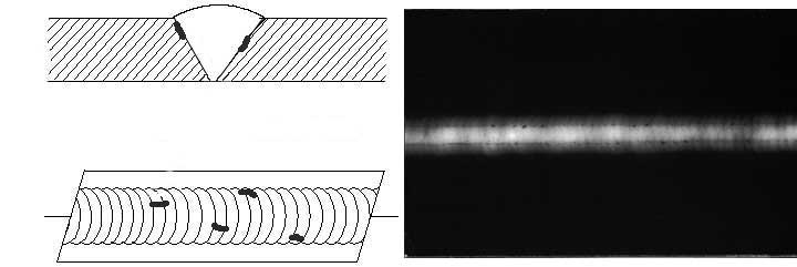 Cross-sectional view, top view, and Radiograph of Lack of Fusion.