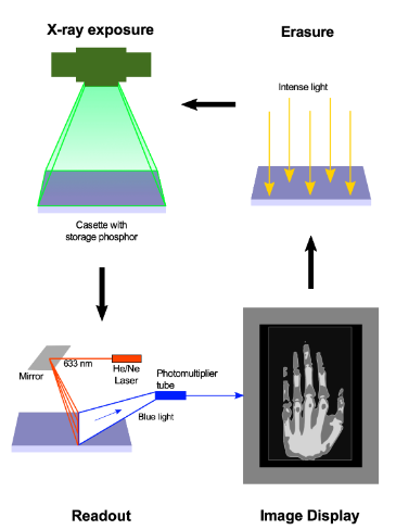 The process of computed radiography. By Beevil from https://commons.wikimedia.org/wiki/File:Computed_Radiography_Process.svg