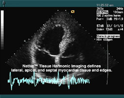 Ultrasound is regulary used to images fetuses that are still in the womb.