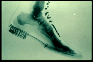  An X-ray image of a foot inside of a shoe. This is one of the first X-ray images.