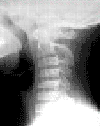  This is an X-ray of a person's spine