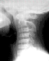 This is an X-ray of a person's spine